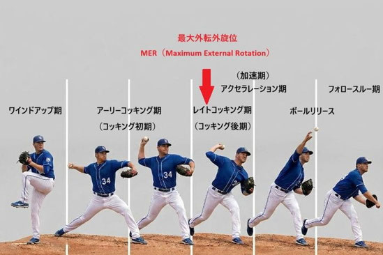野球肘の痛みが出る投球動作局面を確認するためのフェーズ図