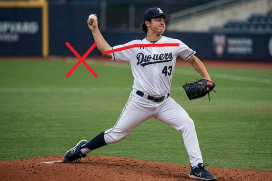 野球のピッチングフォームでトップの肘の高さが肩の高さまで上がっていない為、肘に負担がかかりやすい例