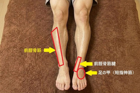 「前脛骨筋」、「前脛骨筋腱」、および「足の甲（短指伸筋）」の痛みが出る部位を赤枠で示している