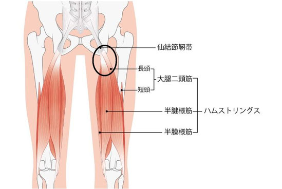 坐骨付近の痛みが出る部位を黒い丸で囲んでいる解剖図（大腿二頭筋・半腱様筋・半膜様筋の付着部）