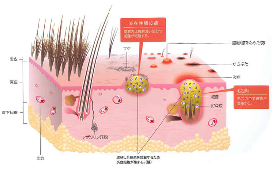 表在性膿皮症・毛包炎