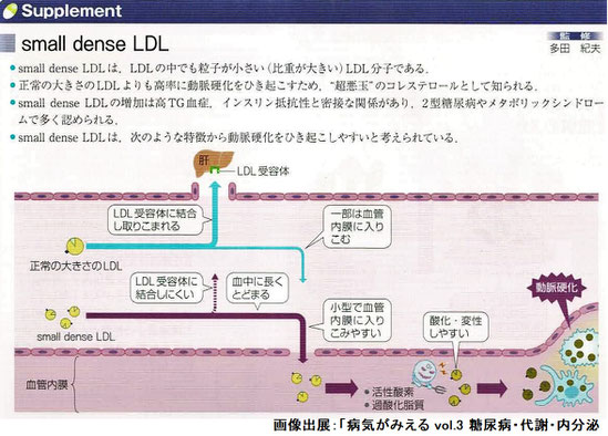 small dense LDL