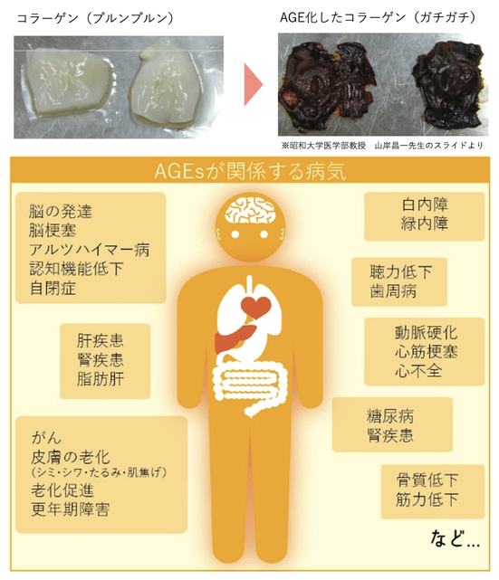 AGEs 終末糖化産物 - AGE Scanner-終末糖化産物測定器/日本正規 AGEs 終末糖化産物 - AGE Scanner-終末糖化産物測定器/日本正規