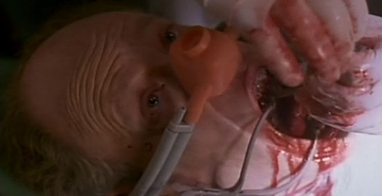 Le Dentiste de Brian Yuzna - 1996 / Horreur - Slasher 