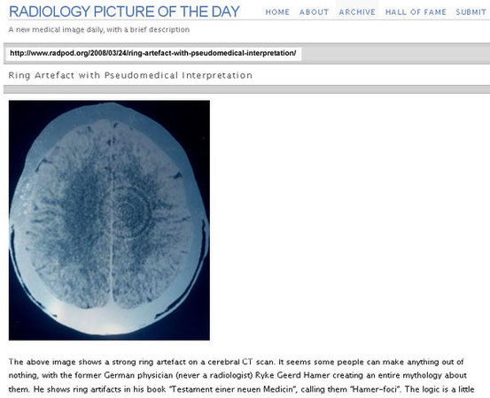 Die gleiche CT-Aufnahme als Beispiel eines Artefaktes in einem Forum von Radiologen
