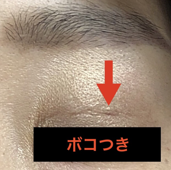 埋没後のボコ付き
