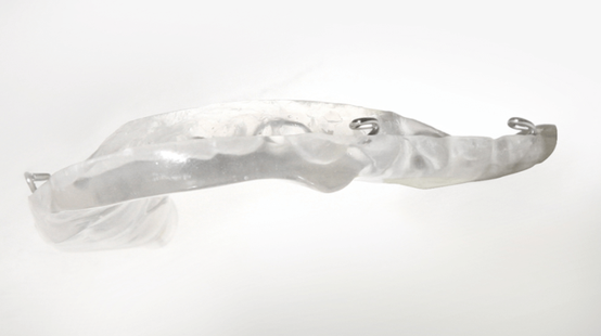 DROS® II – Schiene: Orientierung des Unterkiefers und Stabilisierung der Unterkieferposition.