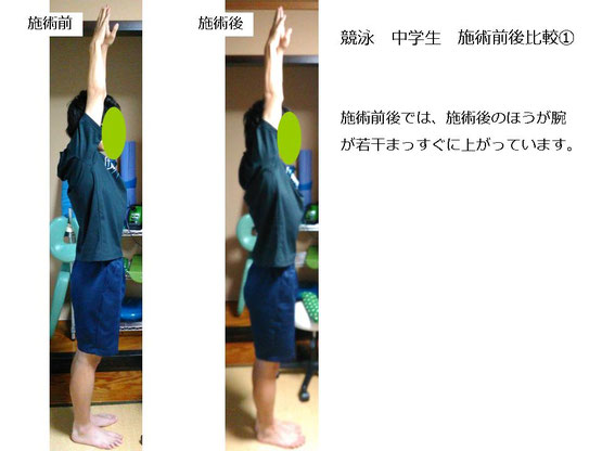 肩関節の痛み　姿勢　肩甲骨　肩甲骨痛み　背中の痛み　野球肩の原因　野球肩原因　野球肩治し方　野球肩体操　野球肩ストレッチ　野球　野球肩　肩が痛い　ピッチャー　リトルリーガーズショルダー　腱板損傷　投球傷害　水泳　競泳　腰痛　分離症　分離すべり症　水泳肩スイマーズショルダー　水泳肩　スイマーズショルダー治療　スイマーズショルダー治るのか　岐阜　岐阜市　岐阜市茜部　岐阜市東鶉　岐阜市南鶉　岐阜市中鶉　岐阜市柳津町　羽島市　羽島郡　笠松町　岐南町　茜部　鶉　東鶉　中鶉　南鶉　柳津　笠松　