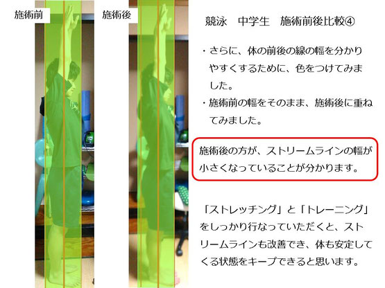 肩関節の痛み　姿勢　肩甲骨　肩甲骨痛み　背中の痛み　野球肩の原因　野球肩原因　野球肩治し方　野球肩体操　野球肩ストレッチ　野球　野球肩　肩が痛い　ピッチャー　リトルリーガーズショルダー　腱板損傷　投球傷害　水泳　競泳　腰痛　分離症　分離すべり症　水泳肩スイマーズショルダー　水泳肩　スイマーズショルダー治療　スイマーズショルダー治るのか　岐阜　岐阜市　岐阜市茜部　岐阜市東鶉　岐阜市南鶉　岐阜市中鶉　岐阜市柳津町　羽島市　羽島郡　笠松町　岐南町　茜部　鶉　東鶉　中鶉　南鶉　柳津　笠松　