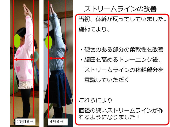 肩関節の痛み 姿勢 肩甲骨 肩甲骨痛み 背中の痛み 野球肩の原因 野球肩原因 野球肩治し方 野球肩体操 野球肩ストレッチ 野球 野球肩 肩が痛い ピッチャー リトルリーガーズショルダー 腱板損傷 投球傷害 水泳 競泳 腰痛 分離症 分離すべり症 水泳肩スイマーズショルダー 水泳肩 スイマーズショルダー治療 スイマーズショルダー治るのか 岐阜 岐阜市 岐阜市茜部 岐阜市東鶉 岐阜市南鶉 岐阜市中鶉 岐阜市柳津町 羽島市 羽島郡 笠松町 岐南町 茜部 鶉 東鶉 中鶉 南鶉 柳津 笠松