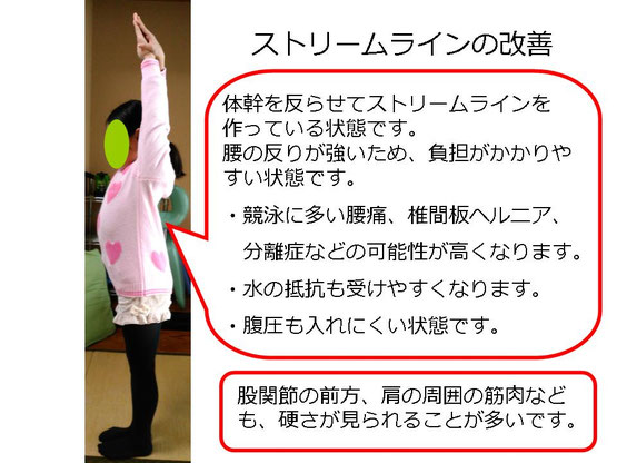 肩関節の痛み 姿勢 肩甲骨 肩甲骨痛み 背中の痛み 野球肩の原因 野球肩原因 野球肩治し方 野球肩体操 野球肩ストレッチ 野球 野球肩 肩が痛い ピッチャー リトルリーガーズショルダー 腱板損傷 投球傷害 水泳 競泳 腰痛 分離症 分離すべり症 水泳肩スイマーズショルダー 水泳肩 スイマーズショルダー治療 スイマーズショルダー治るのか 岐阜 岐阜市 岐阜市茜部 岐阜市東鶉 岐阜市南鶉 岐阜市中鶉 岐阜市柳津町 羽島市 羽島郡 笠松町 岐南町 茜部 鶉 東鶉 中鶉 南鶉 柳津 笠松
