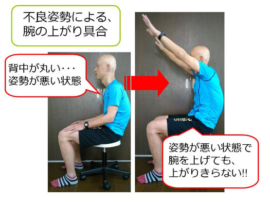 肩関節の痛み　姿勢　肩甲骨　肩甲骨痛み　背中の痛み　野球肩の原因　野球肩原因　野球肩治し方　野球肩体操　野球肩ストレッチ　野球　野球肩　肩が痛い　ピッチャー　リトルリーガーズショルダー　腱板損傷　投球傷害　水泳　競泳　腰痛　分離症　分離すべり症　水泳肩スイマーズショルダー　水泳肩　スイマーズショルダー治療　スイマーズショルダー治るのか　岐阜　岐阜市　岐阜市茜部　岐阜市東鶉　岐阜市南鶉　岐阜市中鶉　岐阜市柳津町　羽島市　羽島郡　笠松町　岐南町　茜部　鶉　東鶉　中鶉　南鶉　柳津　笠松　