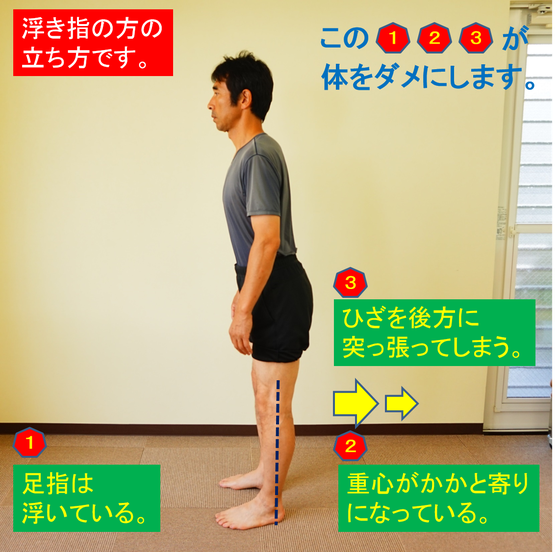 オサモミ整体院 浮き指