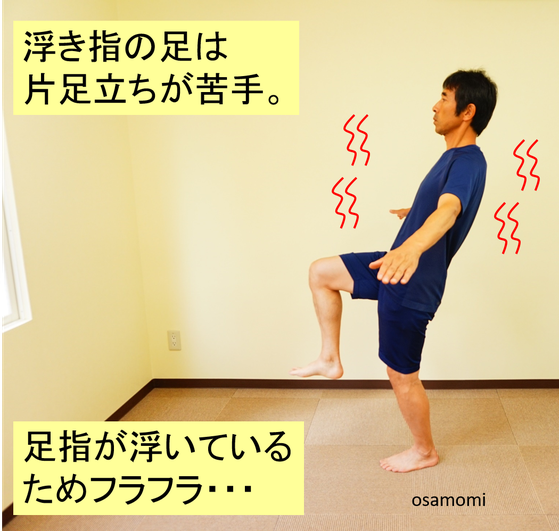 オサモミ整体院 浮き指