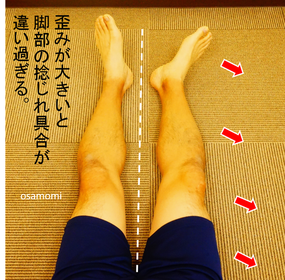 オサモミ整体院 腰痛 浮き指