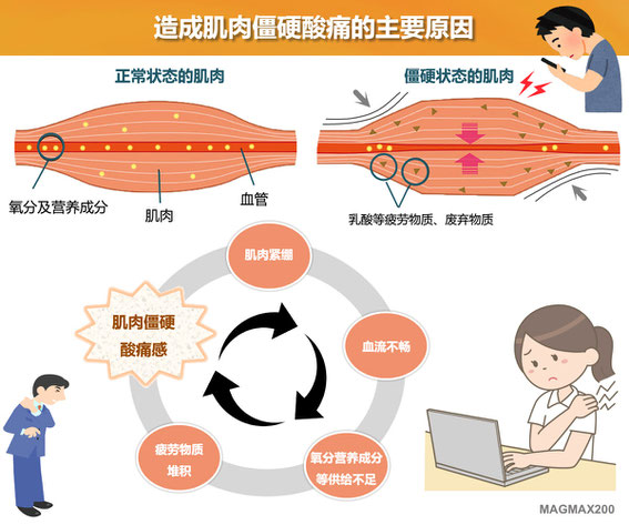 MAGMAX200｜筋肉の凝りや痛みの発生要因