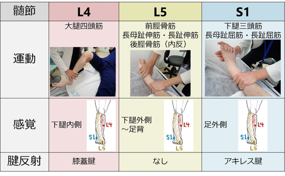 腰部椎間板ヘルニアの神経テストの図表