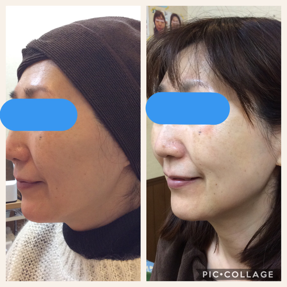 ○重力に負けないV-MAX！ - クィーンメイク21