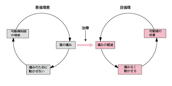 五十肩における痛みの循環