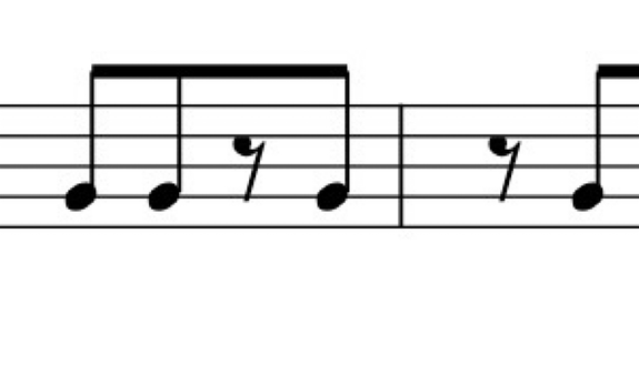 In der Musik haben Pausen ihren festen Platz. 