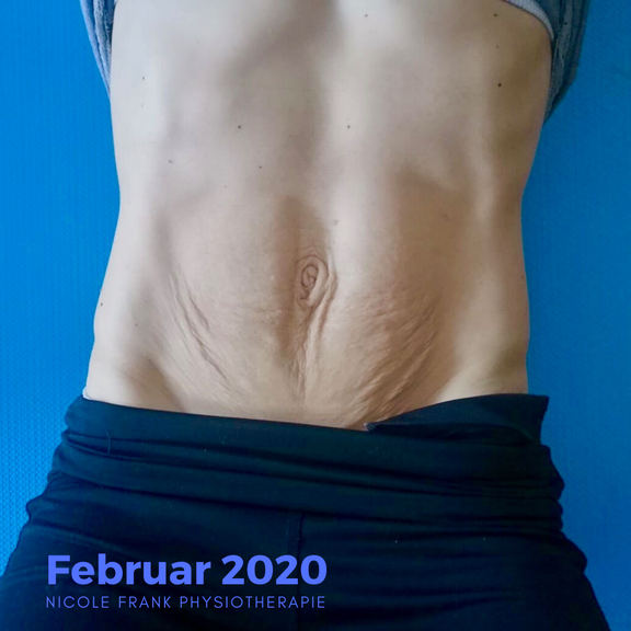 Babybauch Nach Der Geburt