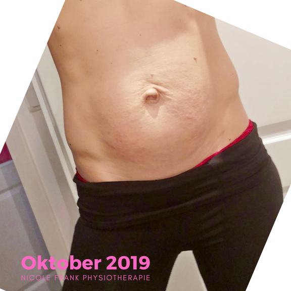Bauch nach der Geburt Nicole Frank Physiotherapie
