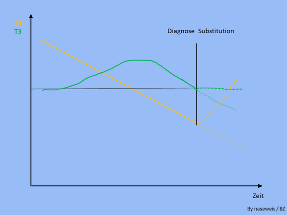 Diagnose im mittleren Stadium und Verlauf T4 und T3 unter Substitution (schematisch)