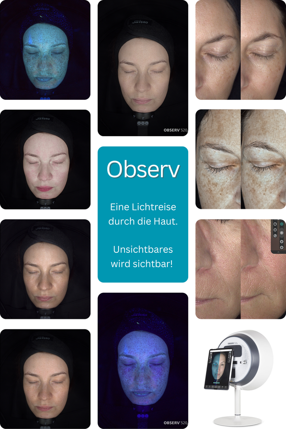 Observ, digitale Hautanalyse