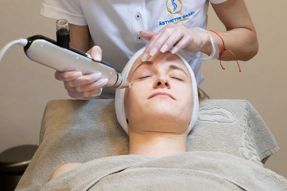Microneedling in Basel Kosmetik