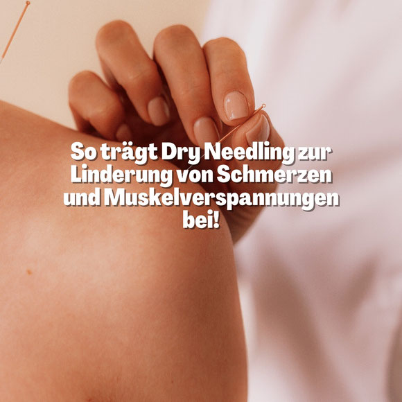 trockenes nadeln in Basel, Dryneedling