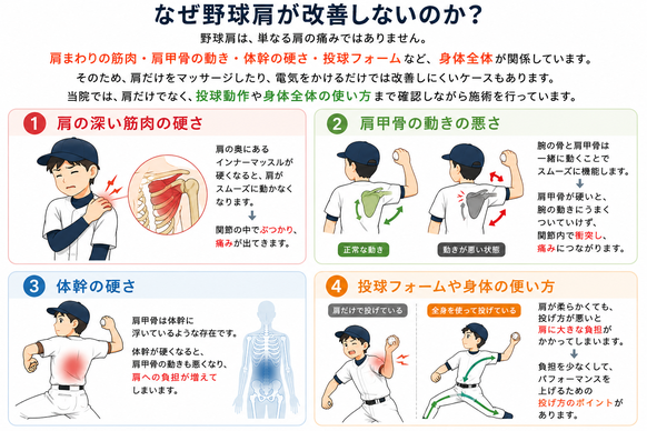 野球肩が改善しない主な原因を図解で解説。肩の深い筋肉（インナーマッスル）の硬さ、肩甲骨の動きの悪さ、体幹の硬さ、投球フォームや身体の使い方が野球肩の痛みに関係しています。