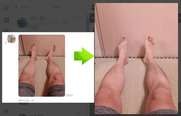 足の爪先が寝ると外を向くときの改善方法
