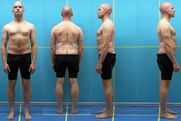 hier sieht man einen Menschen von vorn, hinten rechts und links mit Markern auf Wirbelsäule und Schultern für die Haltungsanalyse, man kann z. B. evtl. Abweichungen und Schiefständen sehen.