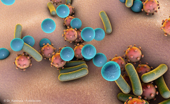 Die Ursachen der Parodontitis - Zahnarztpraxis Hartmann