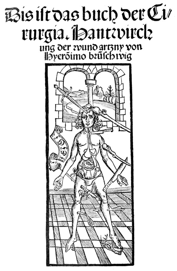 Tielblatt der Straßburger Drucke der Chirurgie Brunschwigs vom Jahr "1397" und 1497.
