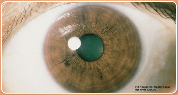 Braune Augen: Schwachstellen: Leber, Galle, Darm und Blut