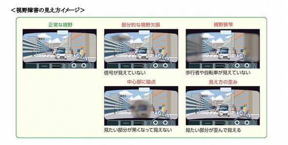 運転者の視野障害のイメージ