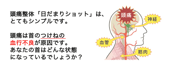頭痛の原因は首の付け根の血行不良です。