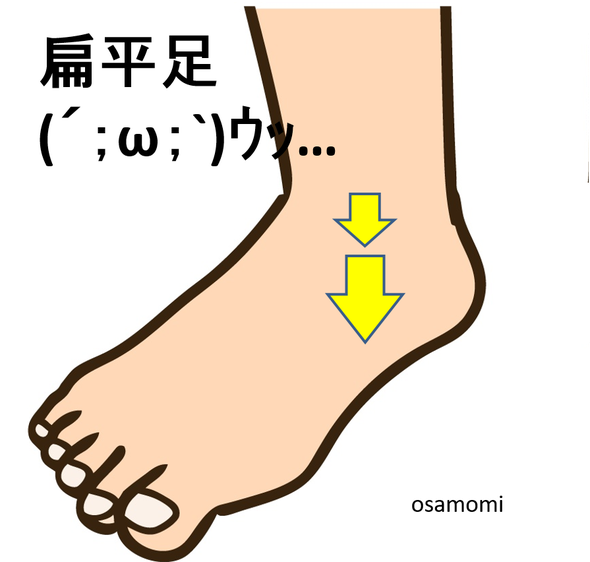 オサモミ整体院 扁平足の原因 後脛骨筋腱