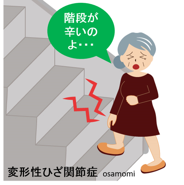 オサモミ整体院 変形性膝関節