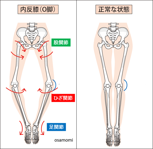 オサモミ整体院 変形性膝関節症