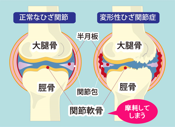 オサモミ整体院 変形性ひざ関節症