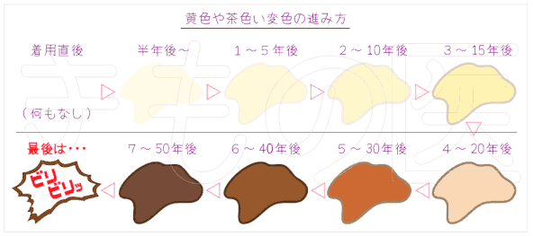 着物の黄ばみ 茶色いしみ変色の進行を超シンプルにご案内 きもの医 格安でも価値ある品質提供