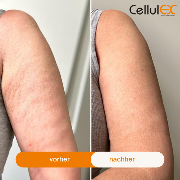 Warum cellulex buchen bei uns?
