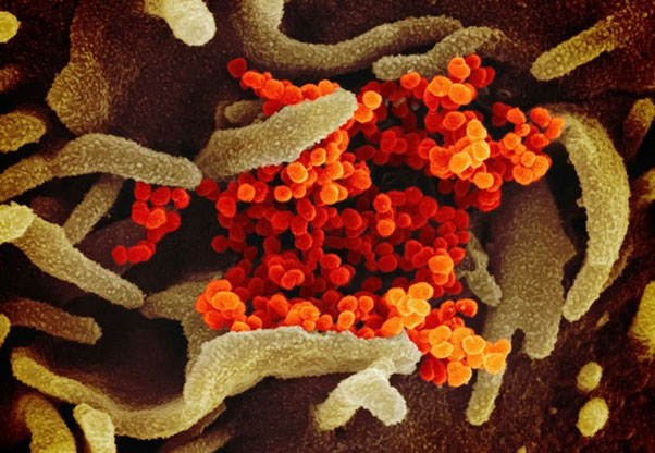 Foto von National Institute of Allergy and Infectious Diseases auf unsplash.com