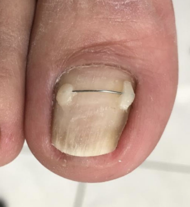 Unser Angebot Podologie Oase Studer