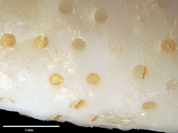 Senckenberg, Bryozoa, Bryozoen, Moostierchen, Sammlung Voigt