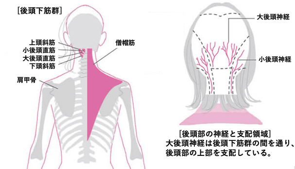 頭痛になる原因は後頭部の詰まりにあります。