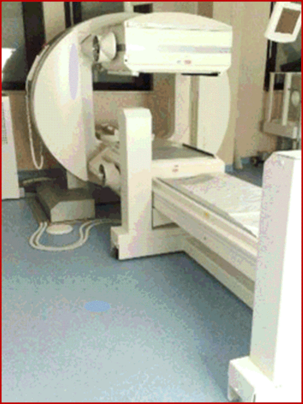 Esempio di gamma camera.