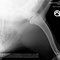 Schulter / shoulder